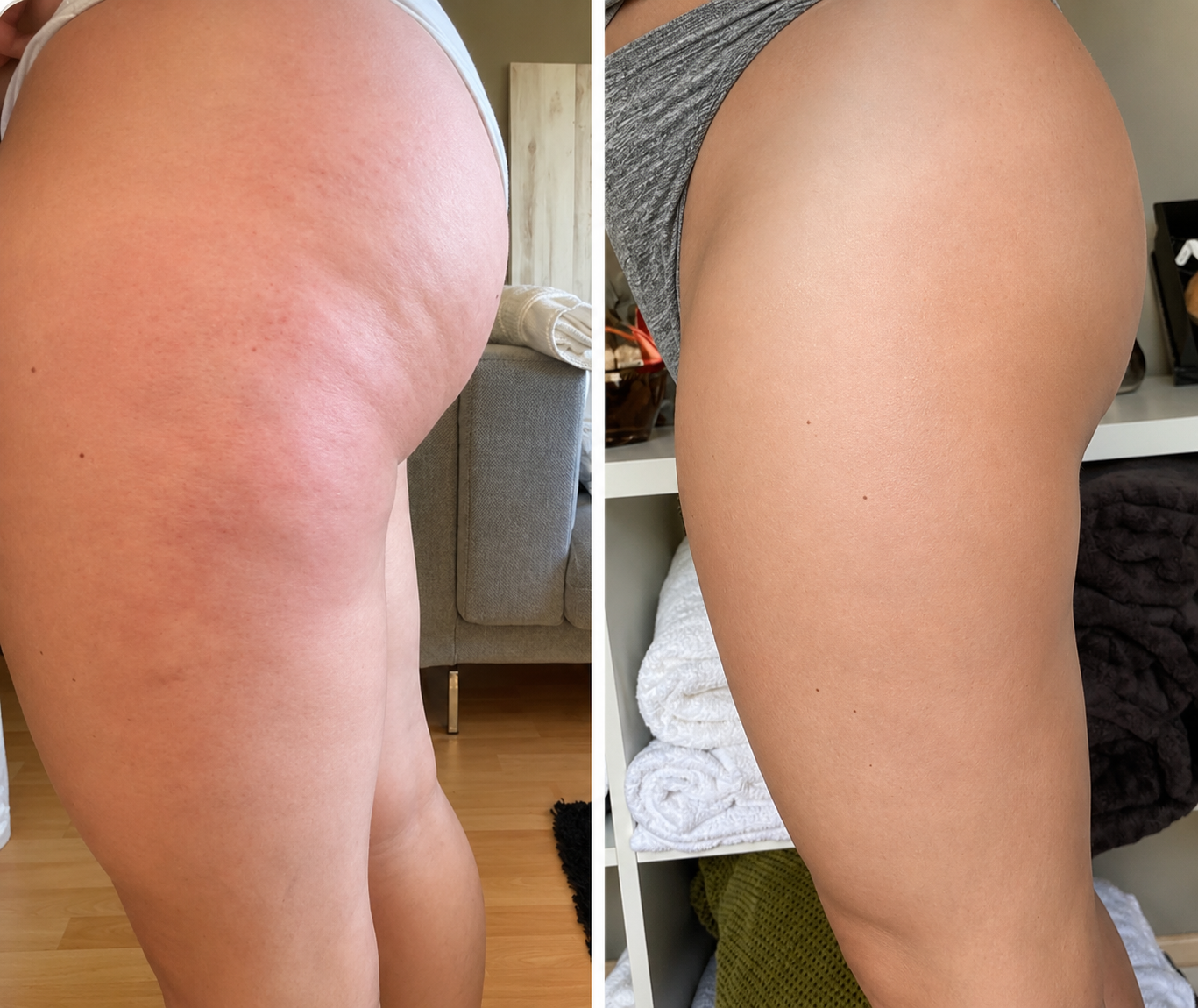 Straffendes Anti-Cellulite-Massageöl