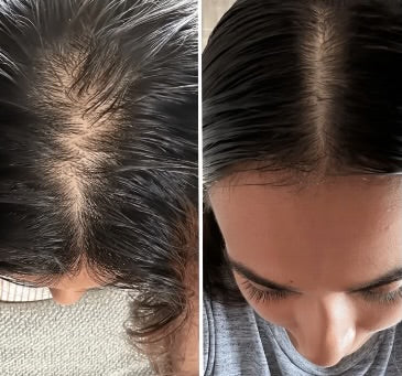 Bowvibe™ Batana-olja för återväxt