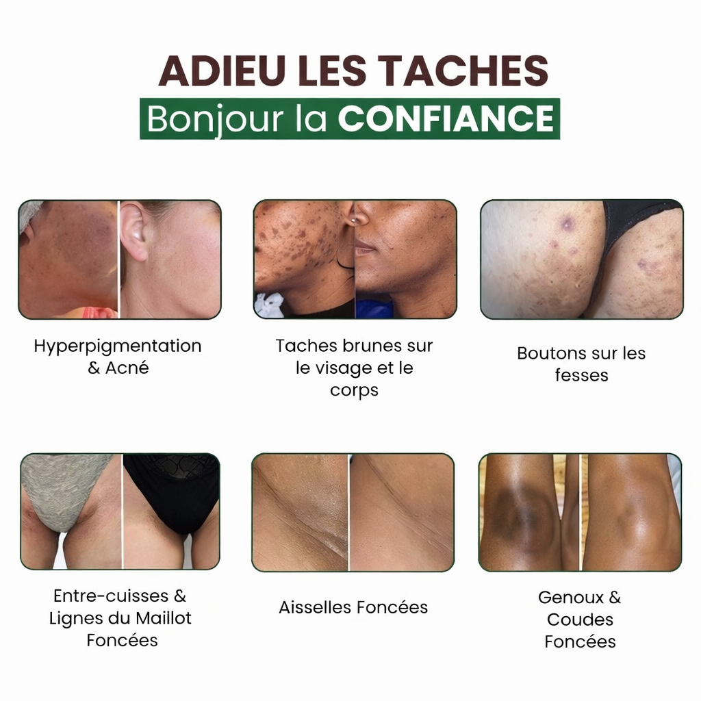 Savon Bowvibe Anti-Taches au Curcuma