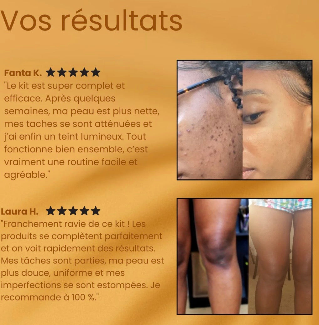 Dite addio alle macchie e all'incarnato irregolare