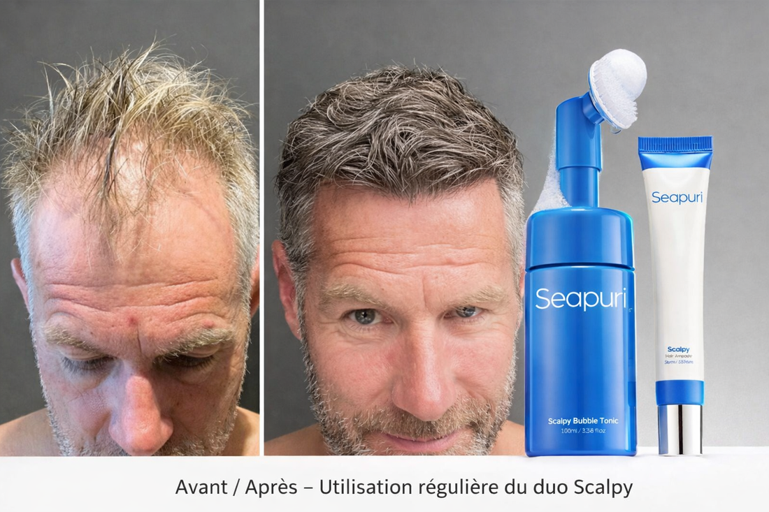 Scalpy Duo – Anti-Chute, Repousse & Densité Capillaire