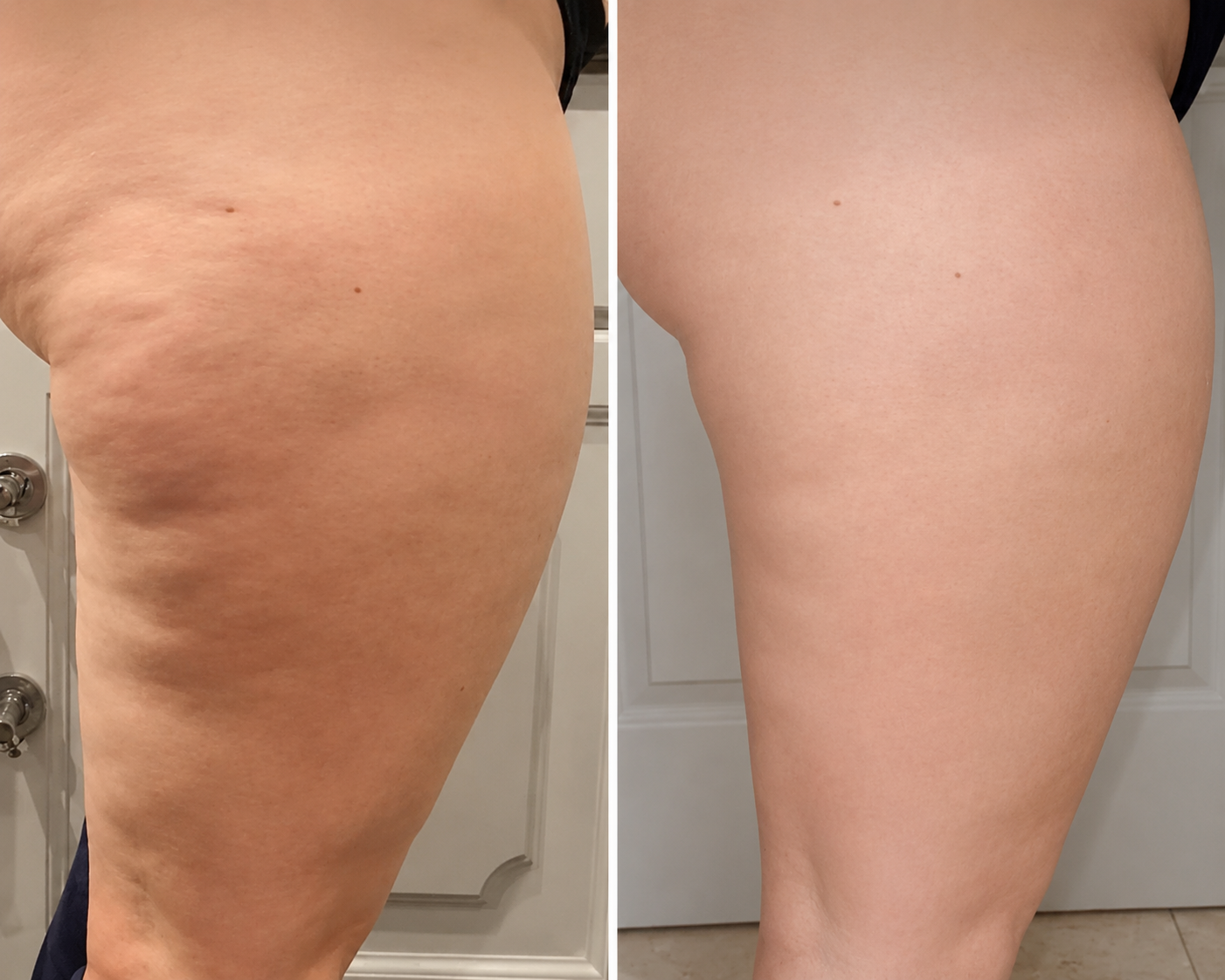 Customer holding body massage device