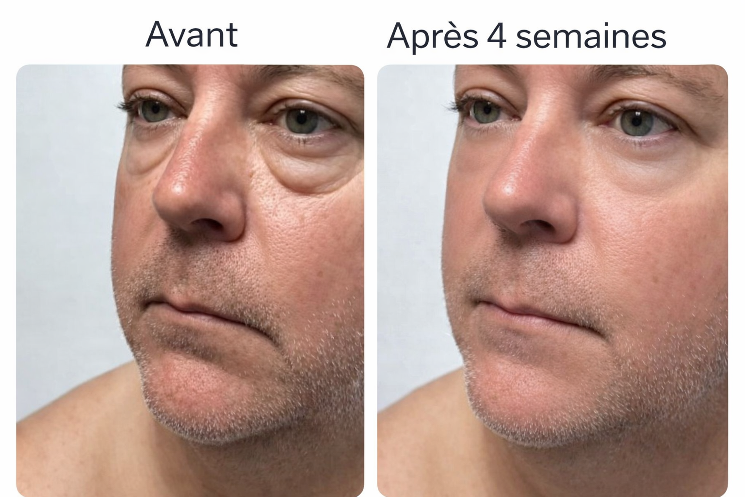 Dúo Reafirmante Rostro y Contorno de Ojos