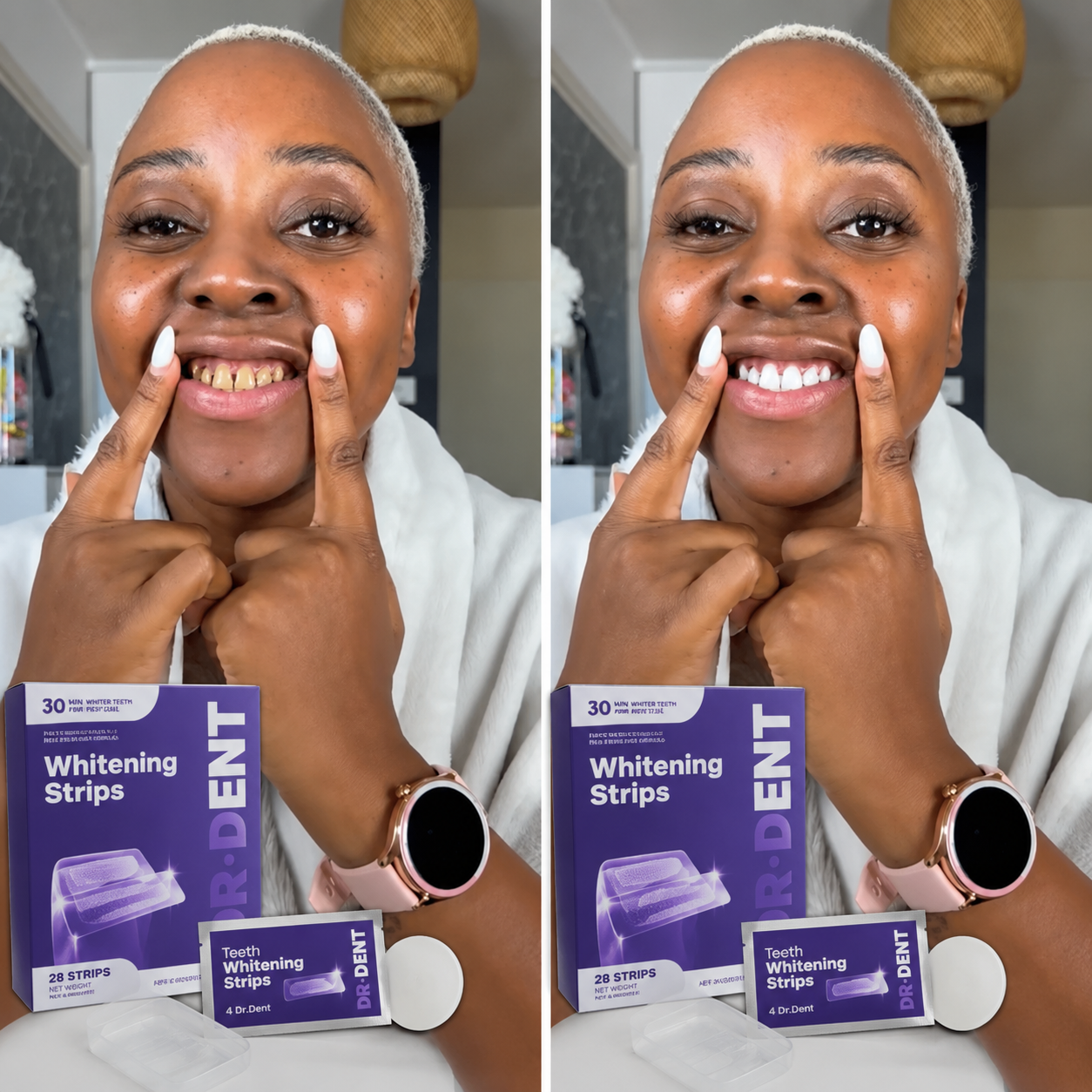 The dazzling smile your dentist charges a fortune for in 30 minutes at home