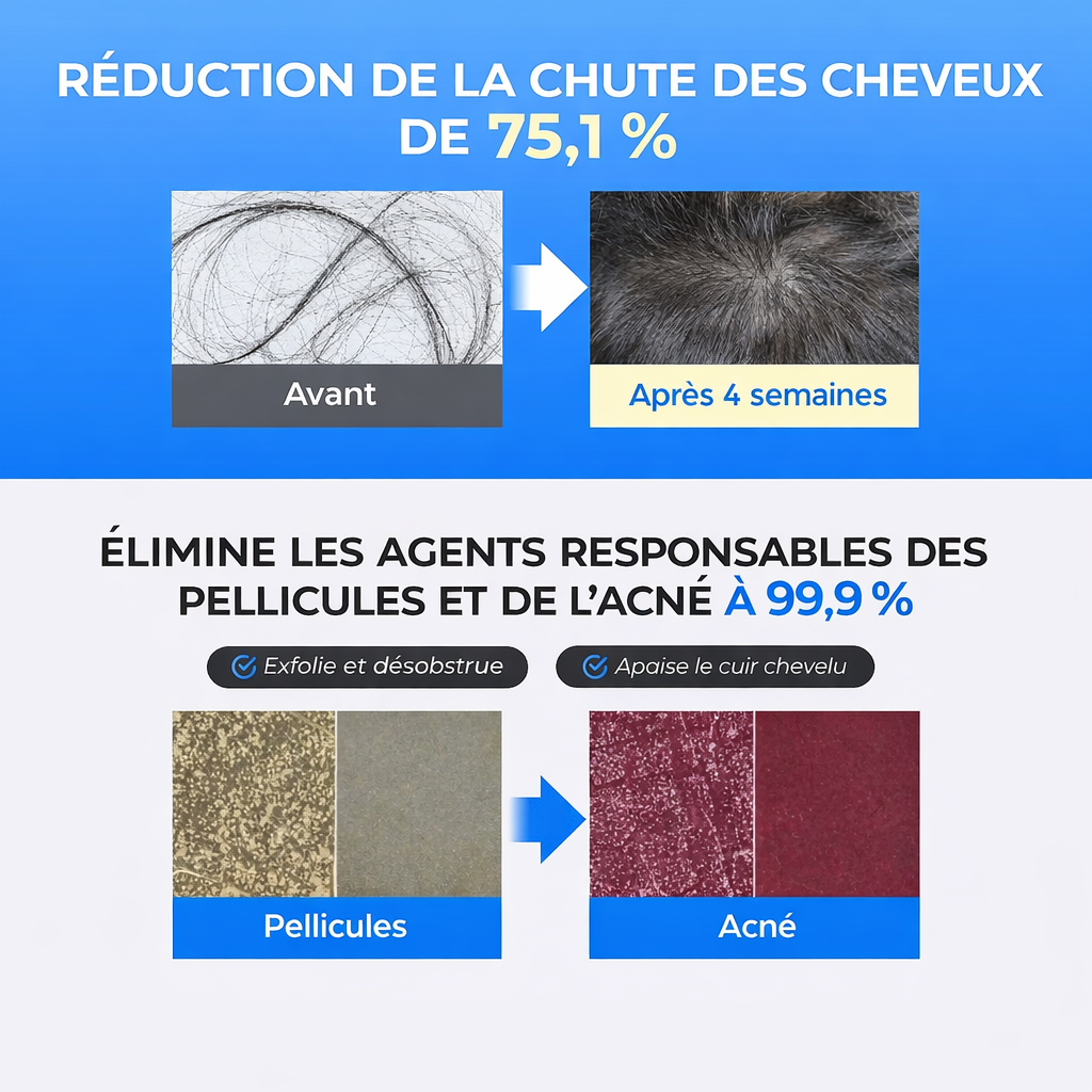 Scalpy Duo – Tratamento Capilar Anti-Queda e Ativação do Crescimento