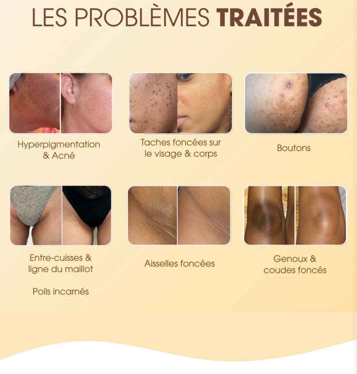 Dite addio alle macchie e all'incarnato irregolare