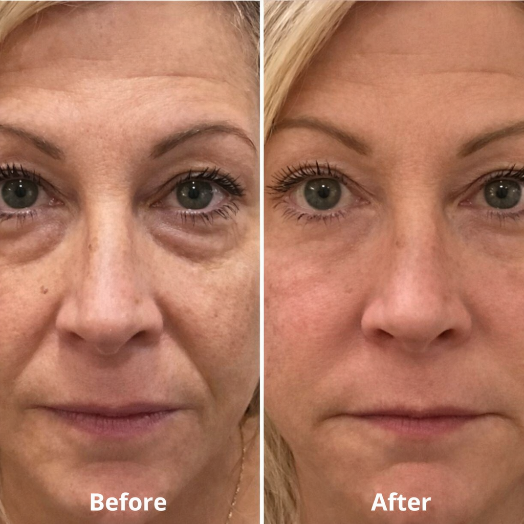 Rutina QINGLIN El ritual anti-edad aclamado
Contorno de ojos y cuerpo