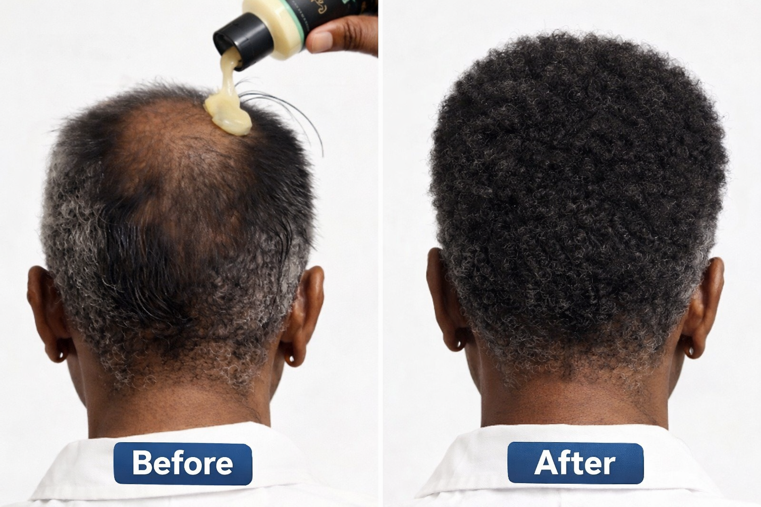 BowVibe® Seapuri® — Mot håravfall, återväxt & hårtäthet