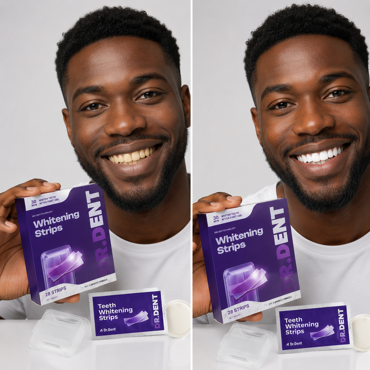 The dazzling smile your dentist charges a fortune for in 30 minutes at home
