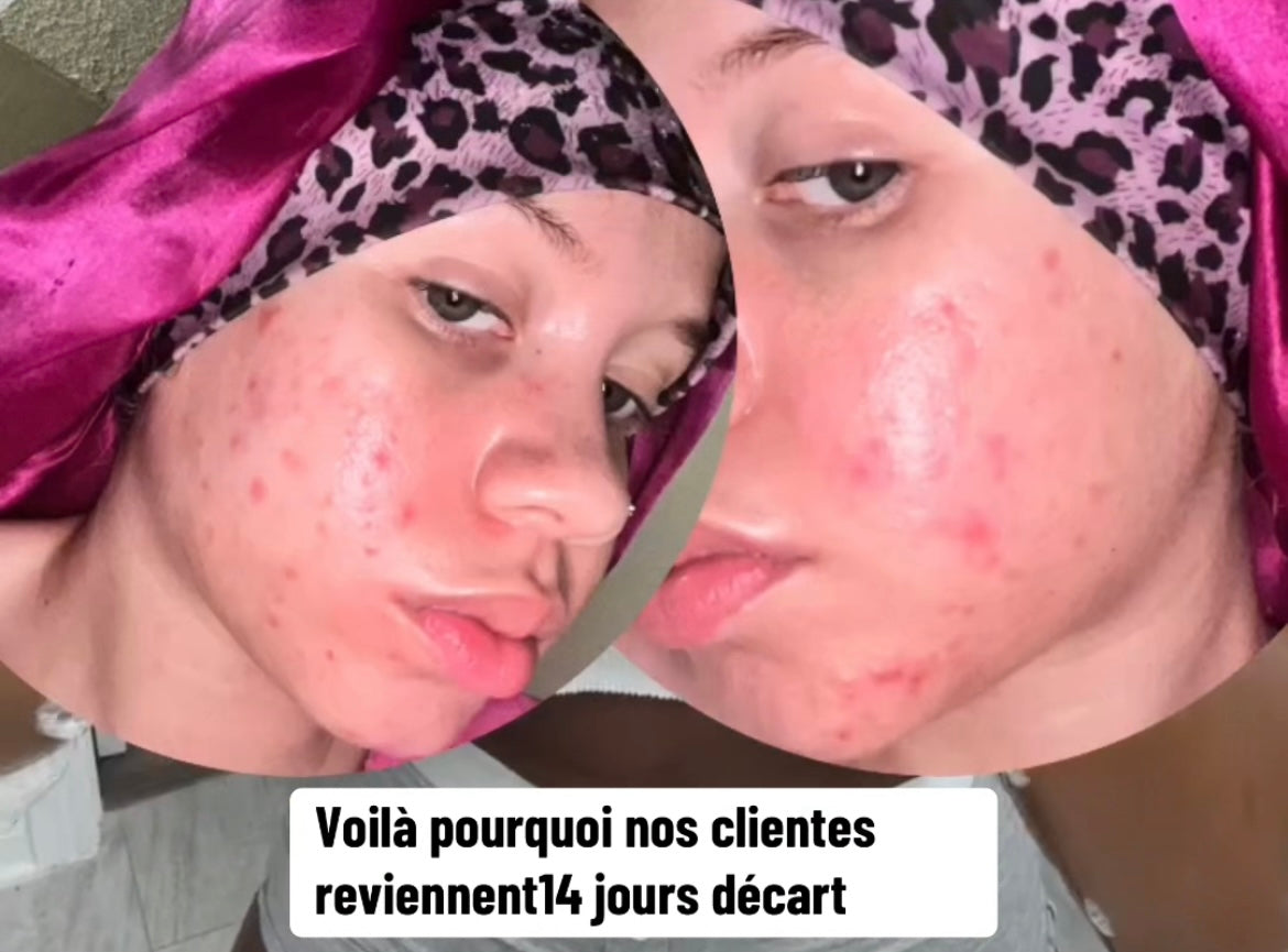 Dites adieu aux taches et au teint terne en 30 jours