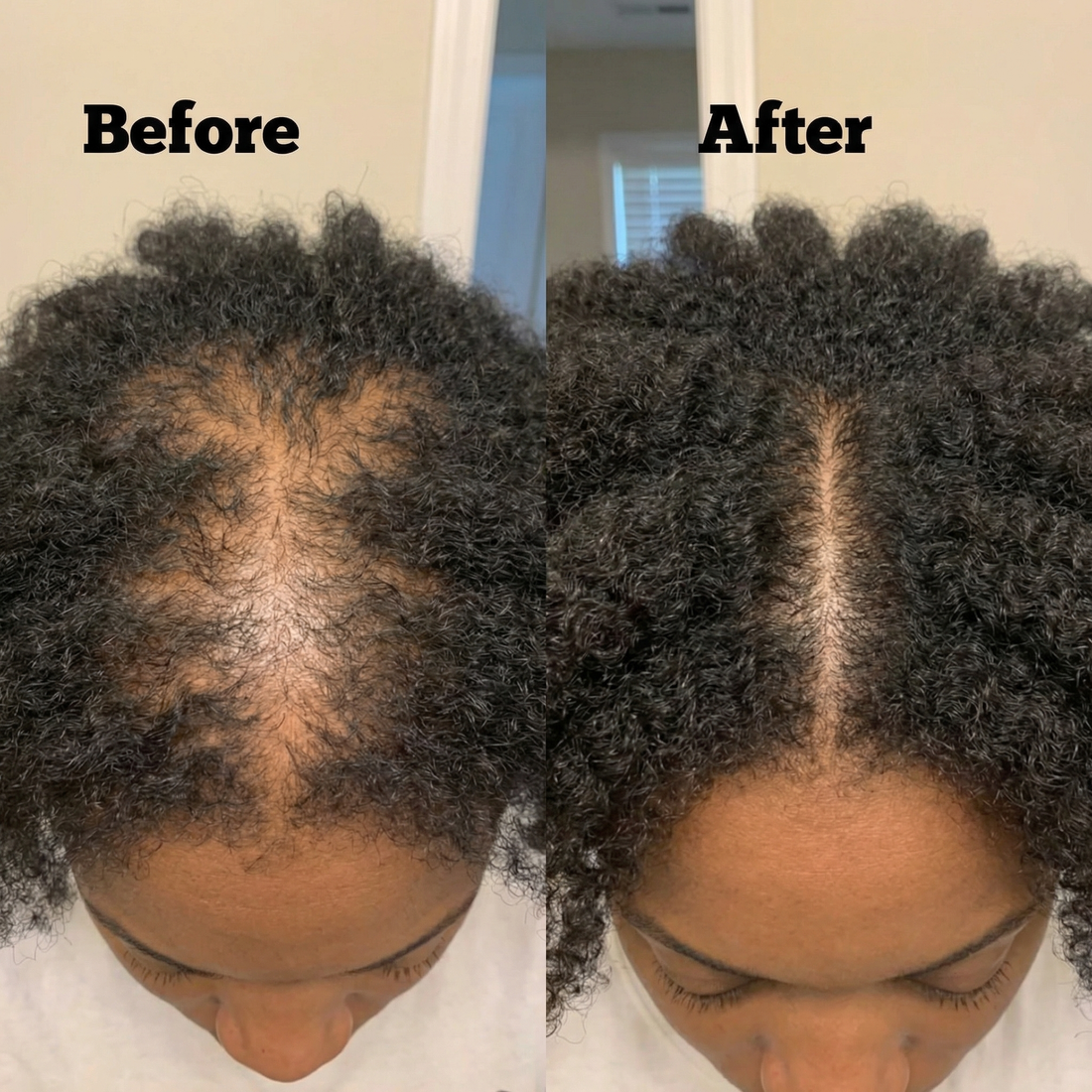 Bowvibe™ Batana-olja för återväxt