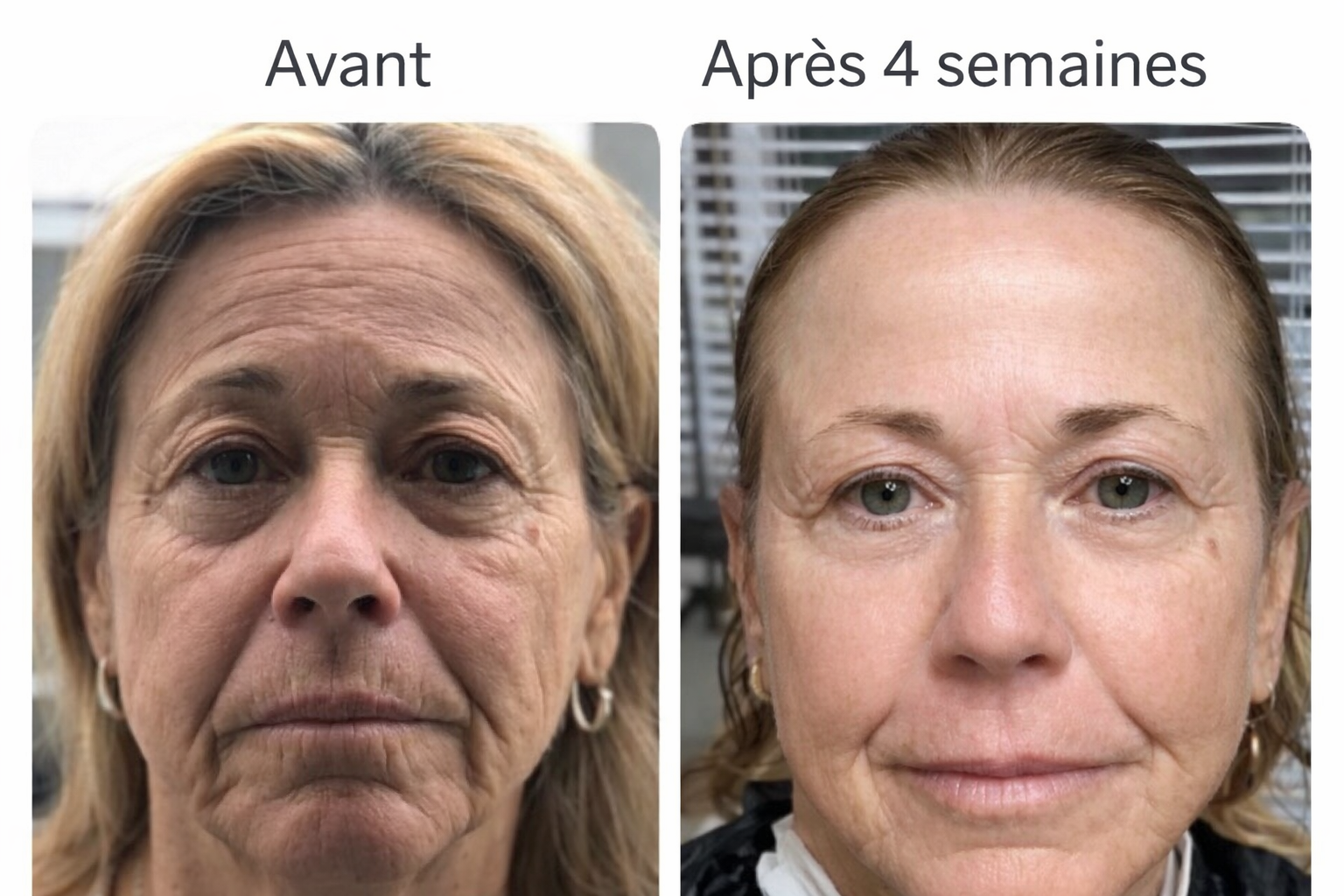 Dúo Reafirmante Rostro y Contorno de Ojos