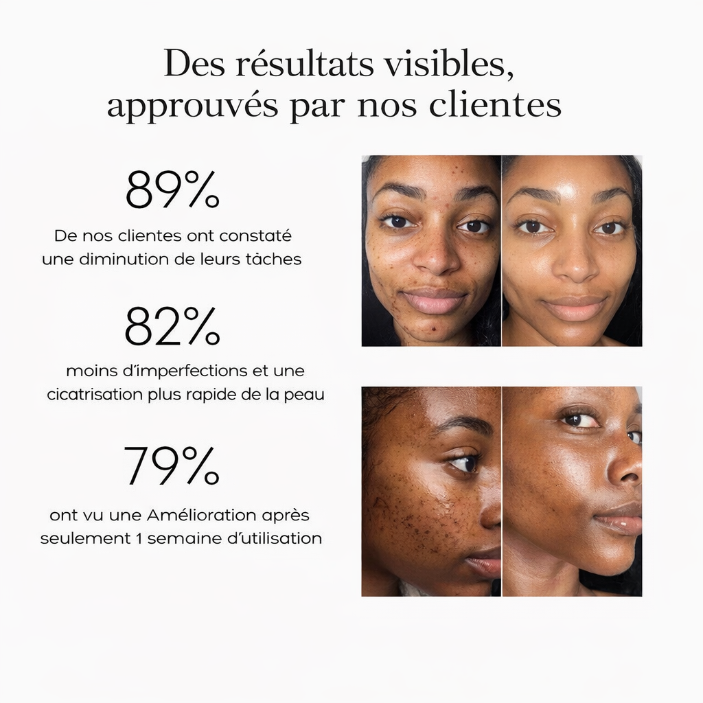 Uniformizează-ți pielea natural, fără să o deschizi la culoare