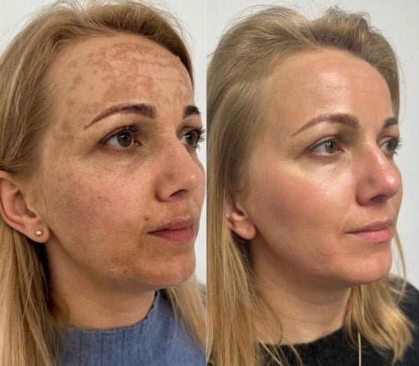 Customer result