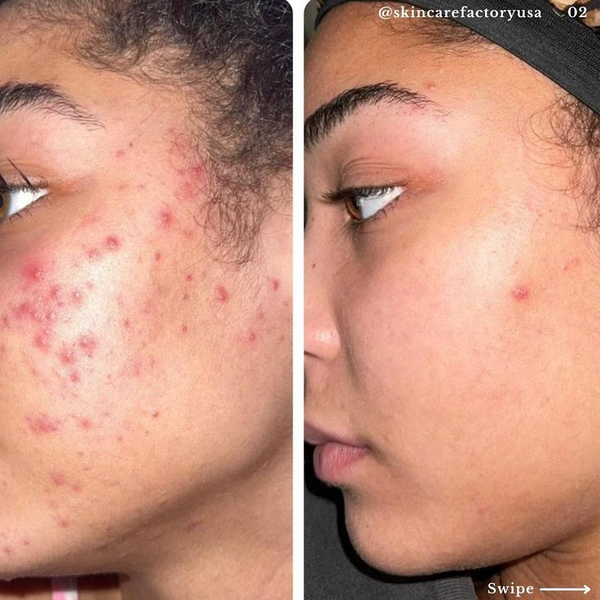 Sérum Anti-Taches Puissant