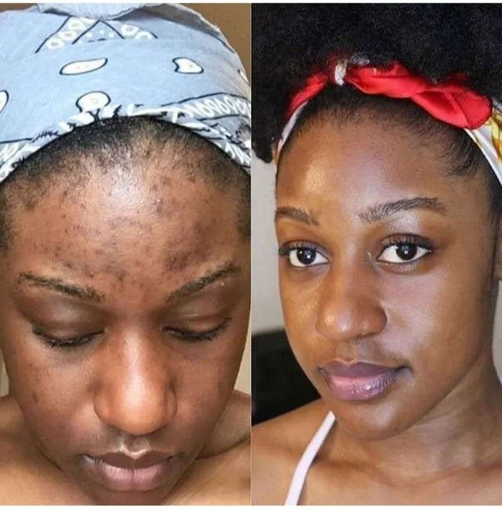 Uniformizează-ți pielea natural, fără să o deschizi la culoare