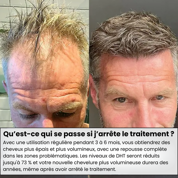 Scalpy Duo Crescimento Capilar