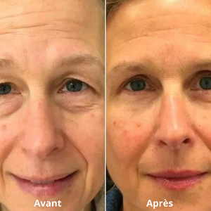 soin contour yeux anti-poches