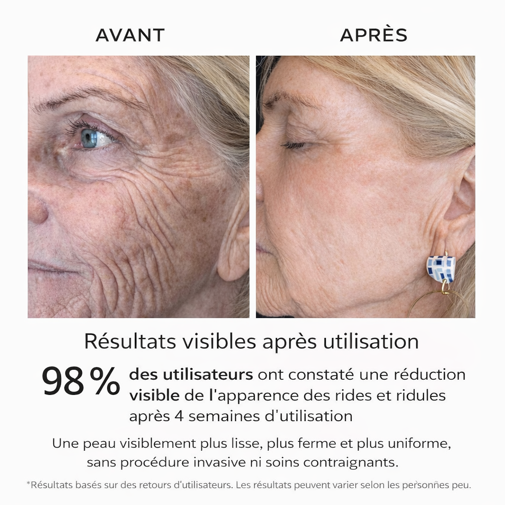 Bowvibe Correction Taches & Rides – Teint Uniforme