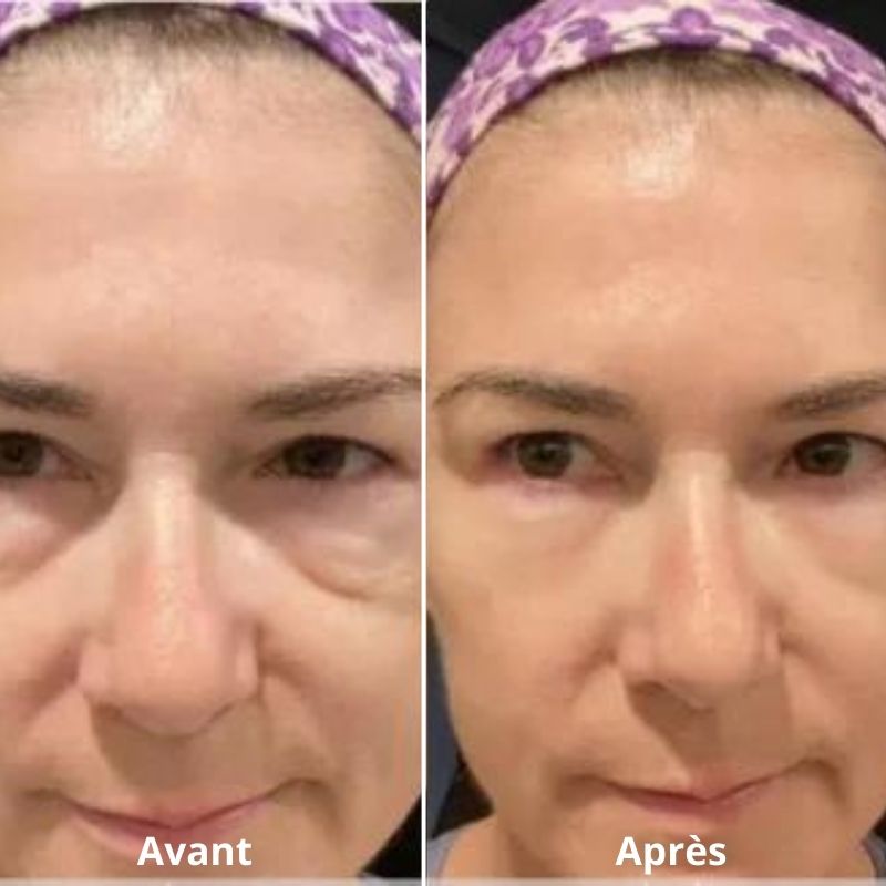 soin contour yeux anti-poches